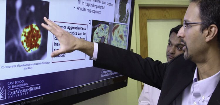 Anant Madabhushi, the Donnell Institute Professor of Biomedical Engineering at CWRU and Amit Gupta, an assistant professor at the CWRU School of Medicine and cardiothoracic radiologist at University Hospitals, review lung tumor vessel features identi