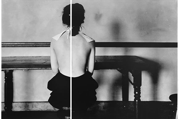 Lisa Oppenhein, Correct posture for 4663. Need for advice of examining physician.,2016